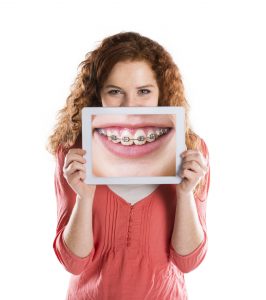 adult braces 1 266x300 - How Sugar Promotes Tooth Decay